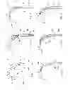 Fig. 08 - Methods of implanting a prosthesis