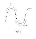 Fig. 02 - Elastic stent graft