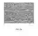 Fig. 03 - Elastic stent graft