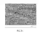 Fig. 04 - Elastic stent graft