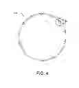 Fig. 06 - Elastic stent graft