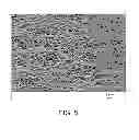 Fig. 08 - Elastic stent graft