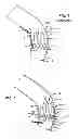 Fig. 02 - ASYMMETRIC STENT APPARATUS AND METHOD