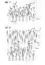 Fig. 03 - ASYMMETRIC STENT APPARATUS AND METHOD