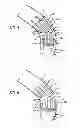 Fig. 04 - ASYMMETRIC STENT APPARATUS AND METHOD