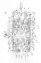 Fig. 02 - Stent