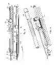Fig. 04 - Valve prosthesis deployment assembly and method