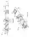 Fig. 06 - Valve prosthesis deployment assembly and method