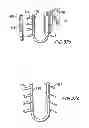 Fig. 40 - Prosthetic heart valve and method