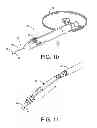 Fig. 07 - Flow promoting ocular implant