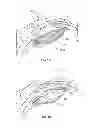Fig. 02 - Intraocular, accommodating lens and methods of use
