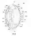 Fig. 06 - Apparatus, system and method for providing a coating for an implantable lens