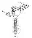 Fig. 02 - Spinal fixation system