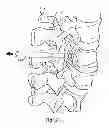 Fig. 22 - Spinal fixation system