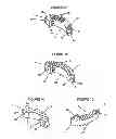 Fig. 02 - Transforaminal intersomatic cage for an intervertebral fusion graft and an instrument for implanting the cage
