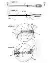 Fig. 04 - Transforaminal intersomatic cage for an intervertebral fusion graft and an instrument for implanting the cage