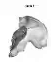 Fig. 07 - Customized surgical guides, methods for manufacturing and uses thereof