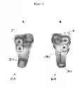 Fig. 09 - Customized surgical guides, methods for manufacturing and uses thereof