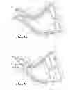 Fig. 06 - Stomach peristalsis device and method