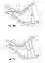 Fig. 07 - Stomach peristalsis device and method