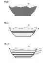 Fig. 04 - Oral implant system for releasing encapsulated food additives by exposure to energy