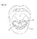 Fig. 09 - Oral implant system for releasing encapsulated food additives by exposure to energy