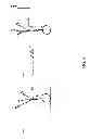 Fig. 05 - Accelerometer leveling in an actively controlled vehicle suspension