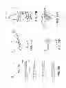 Fig. 110 - Patient-adapted and improved articular implants, designs and related guide tools