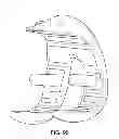 Fig. 137 - Patient-adapted and improved articular implants, designs and related guide tools