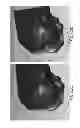 Fig. 141 - Patient-adapted and improved articular implants, designs and related guide tools