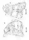 Fig. 145 - Patient-adapted and improved articular implants, designs and related guide tools