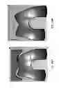 Fig. 149 - Patient-adapted and improved articular implants, designs and related guide tools