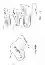 Fig. 151 - Patient-adapted and improved articular implants, designs and related guide tools