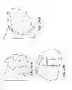Fig. 158 - Patient-adapted and improved articular implants, designs and related guide tools