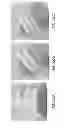 Fig. 161 - Patient-adapted and improved articular implants, designs and related guide tools