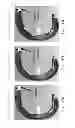 Fig. 182 - Patient-adapted and improved articular implants, designs and related guide tools