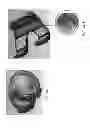 Fig. 187 - Patient-adapted and improved articular implants, designs and related guide tools