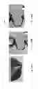 Fig. 191 - Patient-adapted and improved articular implants, designs and related guide tools