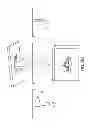 Fig. 201 - Patient-adapted and improved articular implants, designs and related guide tools