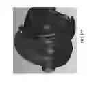 Fig. 211 - Patient-adapted and improved articular implants, designs and related guide tools
