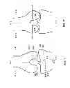 Fig. 22 - Patient-adapted and improved articular implants, designs and related guide tools