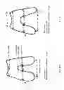 Fig. 33 - Patient-adapted and improved articular implants, designs and related guide tools