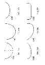Fig. 43 - Patient-adapted and improved articular implants, designs and related guide tools