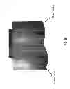Fig. 46 - Patient-adapted and improved articular implants, designs and related guide tools