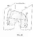 Fig. 48 - Patient-adapted and improved articular implants, designs and related guide tools