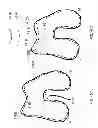 Fig. 52 - Patient-adapted and improved articular implants, designs and related guide tools