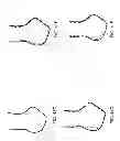 Fig. 58 - Patient-adapted and improved articular implants, designs and related guide tools
