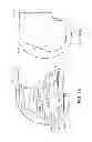 Fig. 63 - Patient-adapted and improved articular implants, designs and related guide tools