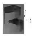 Fig. 64 - Patient-adapted and improved articular implants, designs and related guide tools