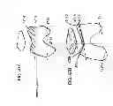 Fig. 65 - Patient-adapted and improved articular implants, designs and related guide tools